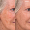 Before and after results of using Jane Iredale Enlighten Plus Under-Eye Concealer variant: No.1