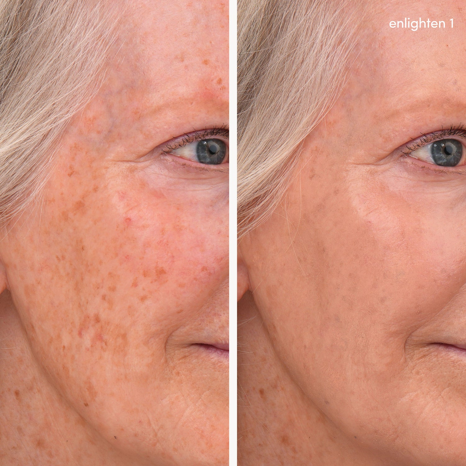 Before and after results of using Jane Iredale Enlighten Plus Under-Eye Concealer variant: No.1