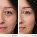 Before and after results of using Jane Iredale Enlighten Plus Under-Eye Concealer variant: No.1