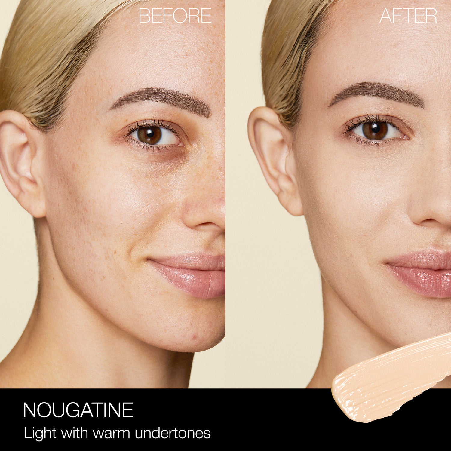 Before and after results of using Nars Radiant Creamy Concealer variant: Nougatine L2.2