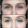 Before and after results of using RMS Beauty ON01 variant: ON01