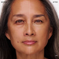 Before and after results of using Ogee Complexion Perfecting Tinted Serum variant: Oak - 5.25N