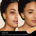 Before and after results of using Nars Radiant Creamy Concealer variant: Praline M3