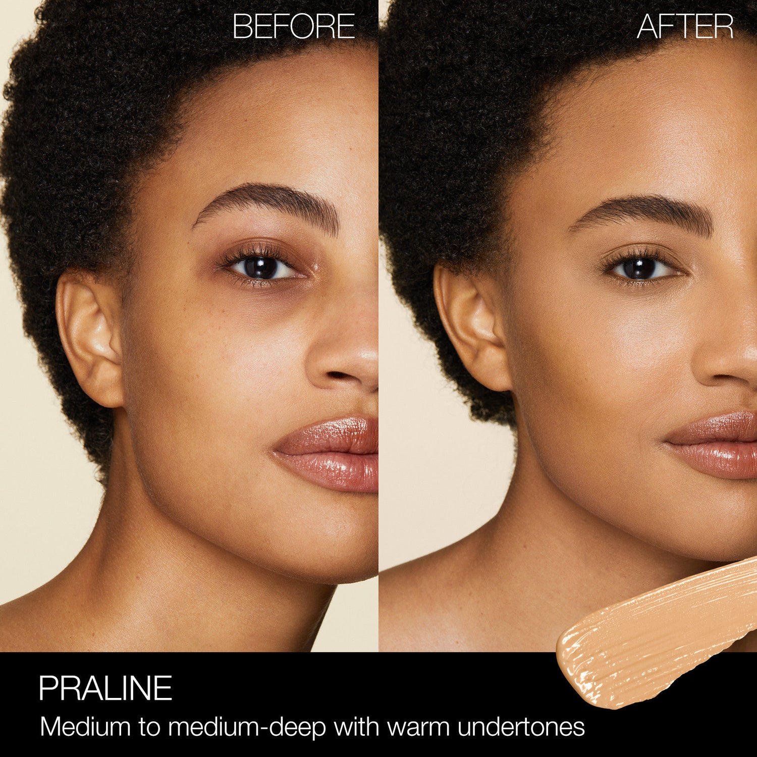 Before and after results of using Nars Radiant Creamy Concealer variant: Praline M3