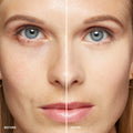 Before and after results of using Bobbi Brown Skin Concealer Stick variant: Sand
