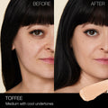Before and after results of using Nars Radiant Creamy Concealer variant: Toffee M1.25