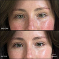 Before and after results of using RMS Beauty Revitalize Hydra Concealer variant: WN04