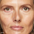 Before and after results of using Bobbi Brown Skin Concealer Stick variant: Warm Beige