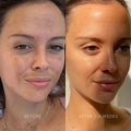 Dr. Barbara Sturm Brightening Face Lotion before and after image .