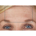SIO Browlift Wrinkle-Smoothing Patches model image 2 .